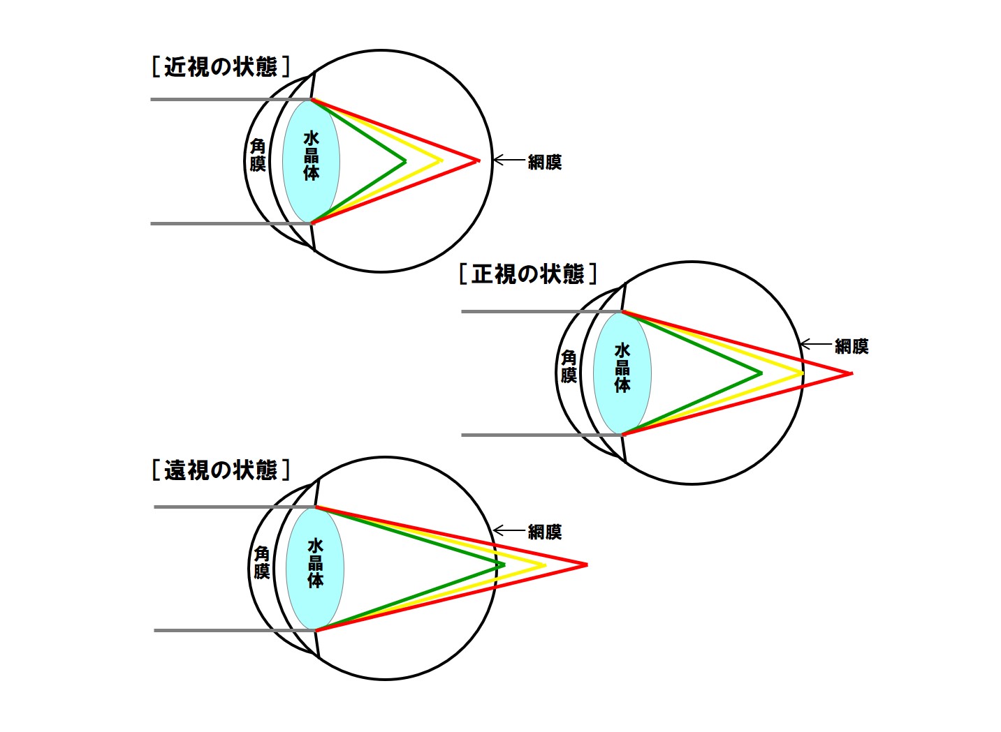 人によって見ている色は違うのかも - からだと心の学習帳〜共感力を養う〜